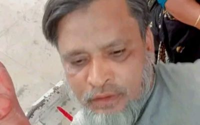 অজ্ঞাত দুষ্কৃতকারী কর্তৃক ধারালো অস্ত্রের আঘাতে ১ জন গুরুতর আহত